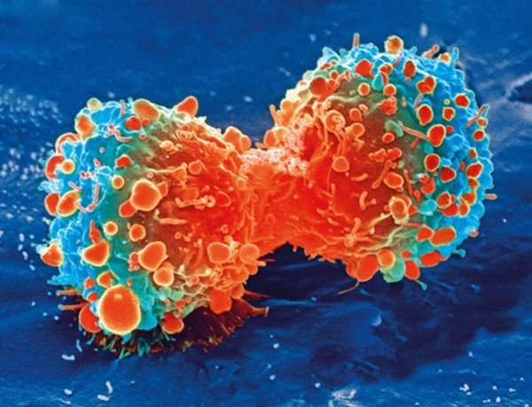 Рак опередил сердечно-сосудистые заболевания как основную причину смерти в 12 странах Европы