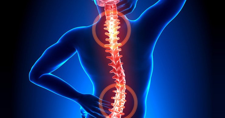 Боли в спине связаны с повышенным риском смерти