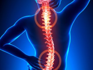 Боли в спине связаны с повышенным риском смерти
