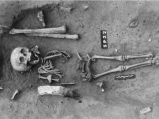Найден древнейший скелет человека с синдромом Дауна