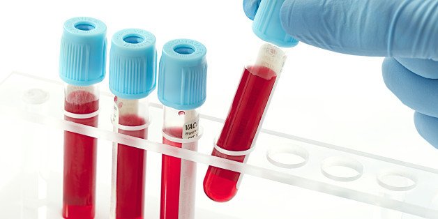 Простой анализ крови позволяет диагностировать 8 видов рака