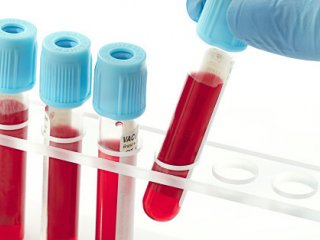 Простой анализ крови позволяет диагностировать 8 видов рака