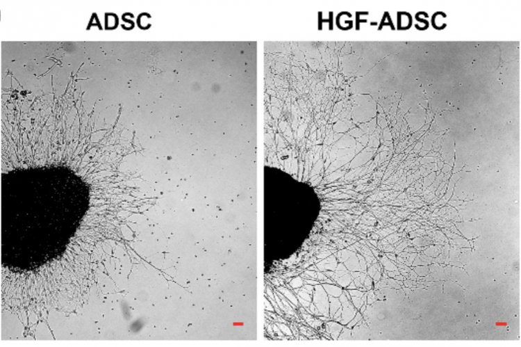 Микрофотография аксонов культуры нейронов дорсального корешкового ганглия при воздействии обычных МСК (слева) и генномодифицированных МСК (справа) // Источник: International Journal of Molecular Sciences. DOI: 10.3390/ijms20123088.