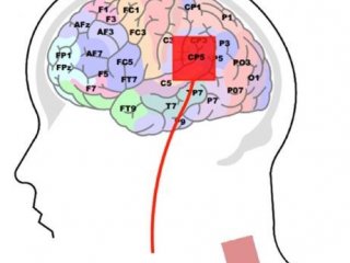 Катодная электростимуляция мозга в области зоны Вернике может помочь лучше запоминать абстрактные слова