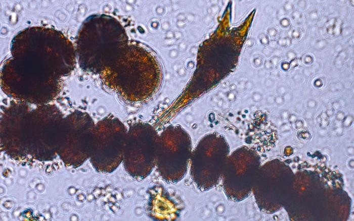 Цепочка Alexandrium monilatum под Tripos furca. Оба вида представляют собой миксопланктон, который был собран во время цветения Alexandrium monilatum в конце лета в реке Йорк в Глостере. Фото: Heather Corson / Virginia Institue of Marine Science