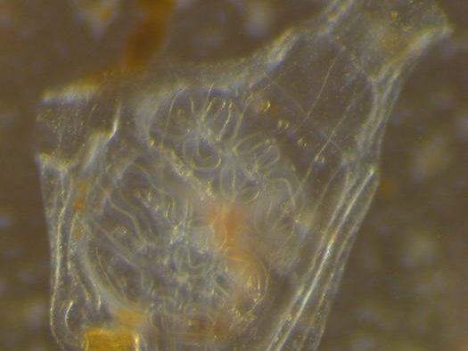 Молодая асцидия. Фото: Shunsuke Sogabe / University of St. Andrews