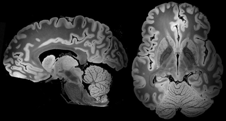 100-часовое МРТ зафиксировало самое детальное изображение мозга человека