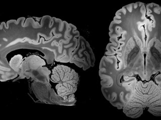 100-часовое МРТ зафиксировало самое детальное изображение мозга человека