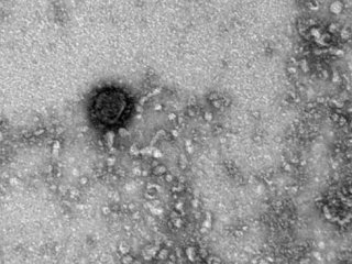 Чужого не надо: в России не нашли новых штаммов коронавируса