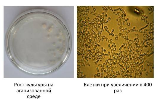 Бактерии Yarrowia lipolytica