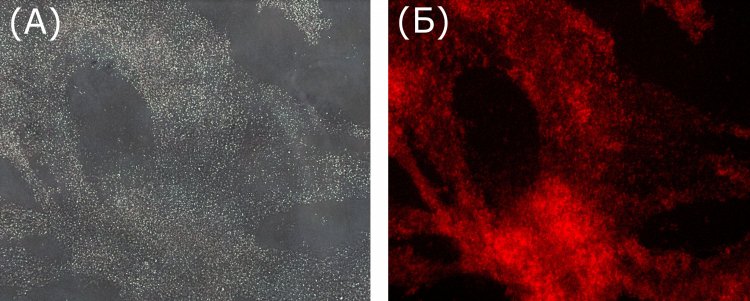 Микроскопические изображения бактериальных биопленок после окрашивания флуоресцентными золотыми нанокластерами. Источник: Стелла Евстигнеева