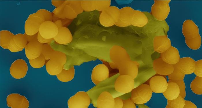 Изображение, полученное с помощью электронного микроскопа, показывает, как бактерии Enterococcus faecalis собираются вместе и, помимо прочего, делятся друг с другом устойчивостью к антибиотикам. Фото: Josy ter Beek / Umeå University