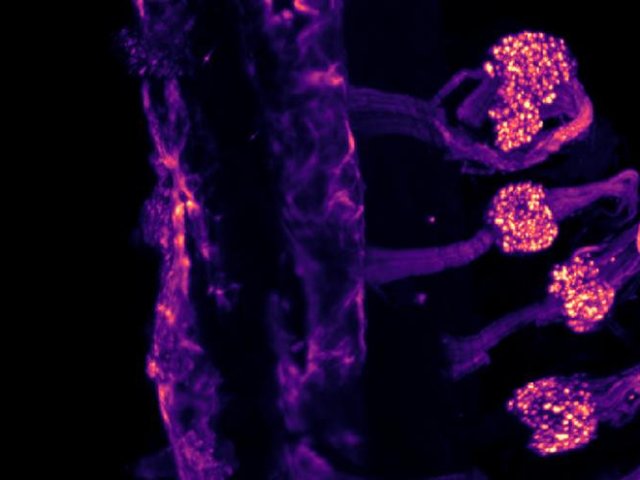 Изображение, полученное с помощью световой микроскопии, демонстрирующее экспрессию ионного канала TRPM8 в сенсорных ганглиях мыши во время эмбрионального развития после очистки тканей. Фото: Pablo Hernández-Ortego / Universidad Miguel Hernandez de Elche