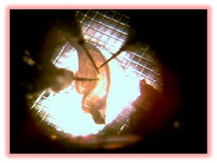 Изображение срезов гиппокампа с электродами. Фото: NUS Medicine / Brian K Kennedy