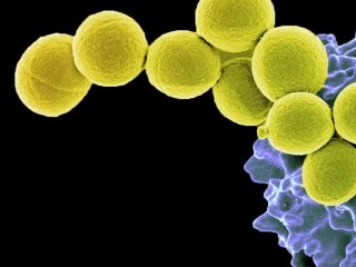 Ученые КФУ, ИБ РАН и их зарубежные коллеги выяснили, почему золотистый стафилококк устойчив к антибиотикам