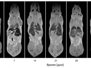 МРТ-изображения мышей в различные периоды времени после введения наночастиц. Видно накопление наночастиц в печени и селезенке и снижение контраста этих органов с течением времени