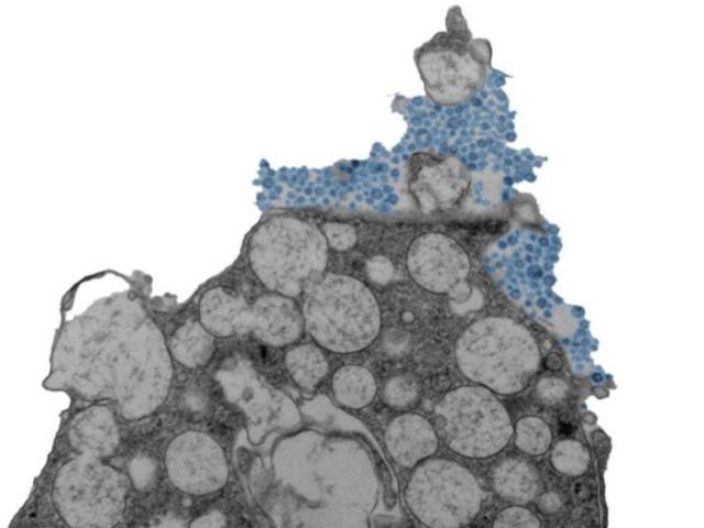 Электронная микрофотография, на которой показана клетка эпителия носовой полости человека, высвобождающая риновирус (синий цвет). Фото: Julien Amat & Bao Wang