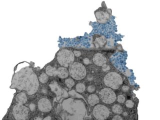 Электронная микрофотография, на которой показана клетка эпителия носовой полости человека, высвобождающая риновирус (синий цвет). Фото: Julien Amat & Bao Wang