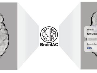 BrainIAC — это универсальная базовая модель для нейровизуализации, которая поддерживает различные клинические задачи, от прогнозирования молекулярных подтипов до оценки старения мозга и выживаемости. Фото: Divyanshu Tak, Mass General Brigham