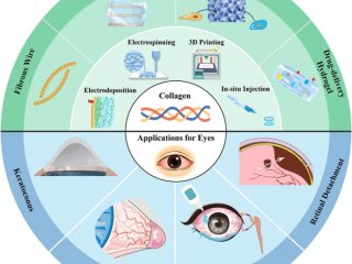 Методы обработки и изготовления коллагена и их применение для лечения заболеваний глазных тканей. Фото: Xue Qu / Eye Discovery
