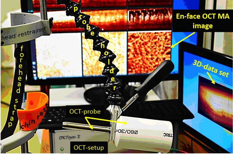 В ИПФ РАН создан мультимодальный оптический когерентный томограф для визуализации микрокровотока