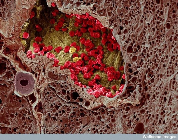 Ученые остановили развитие рака кожи у мышей, блокируя работу определенных белков